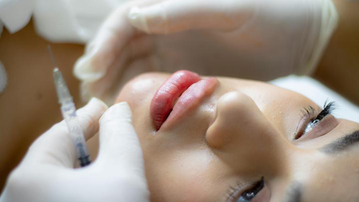 Restylane filler HA