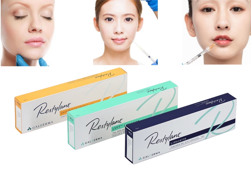 Restylane filler