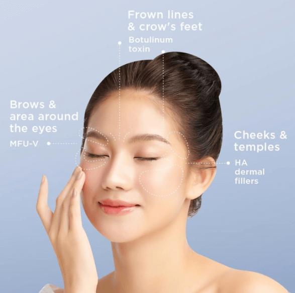 botox-dermal-filler