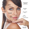 Allergan Botox 100Units Botulinum Toxin A Reduces Wrinkles And Fine Lines