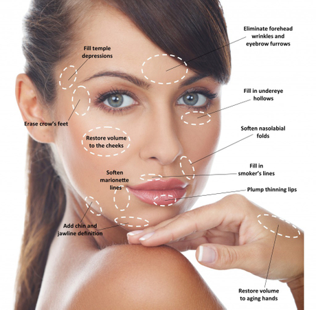 Dermal-Fillers-2.jpeg
