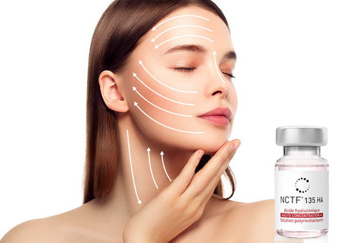 3-Mesoterapia-facial-con-NCTF-135-HA-fillmed