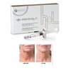 Profhilo H+L Anti-Wrinkle Injectable Hyaluronic Acid Dermal Filler for Effective Face Lifting