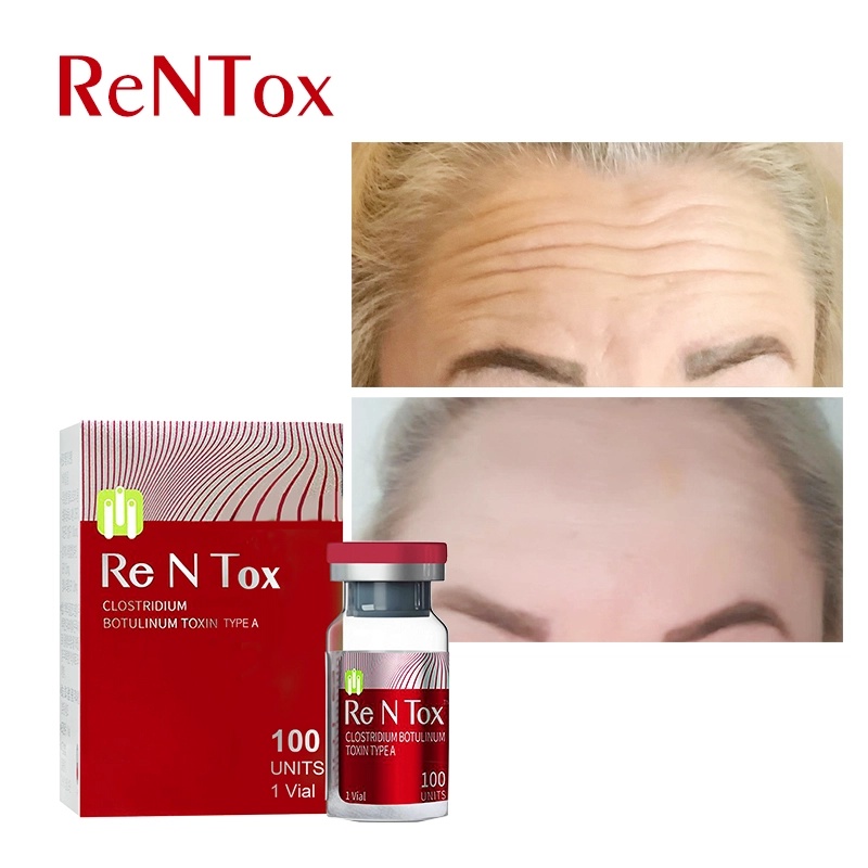 Botulinum-Toxin-Ren-Tox-100-units_副本.jpg