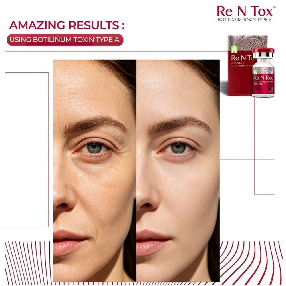 0166191001711694494-rentox-u-200u-anti-w.jpg_副本.jpg