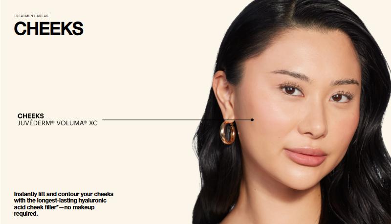 voluma xc cheeks1.jpg